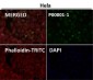 Anti-p53 (acetyl K370) TP53 Rabbit Monoclonal Antibody